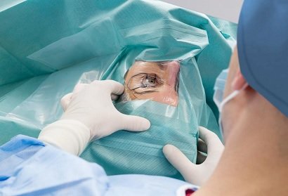 The Role of a Cataract Eye Surgeon: Restoring Vision with Precision and Care
